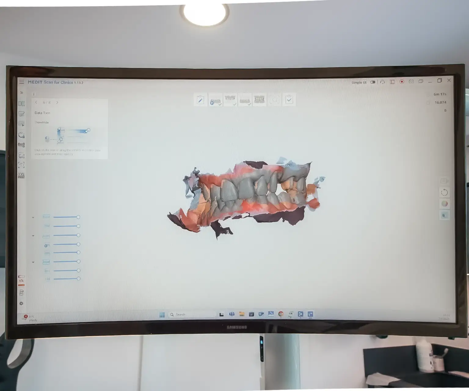 3d snimka oralnog skenera