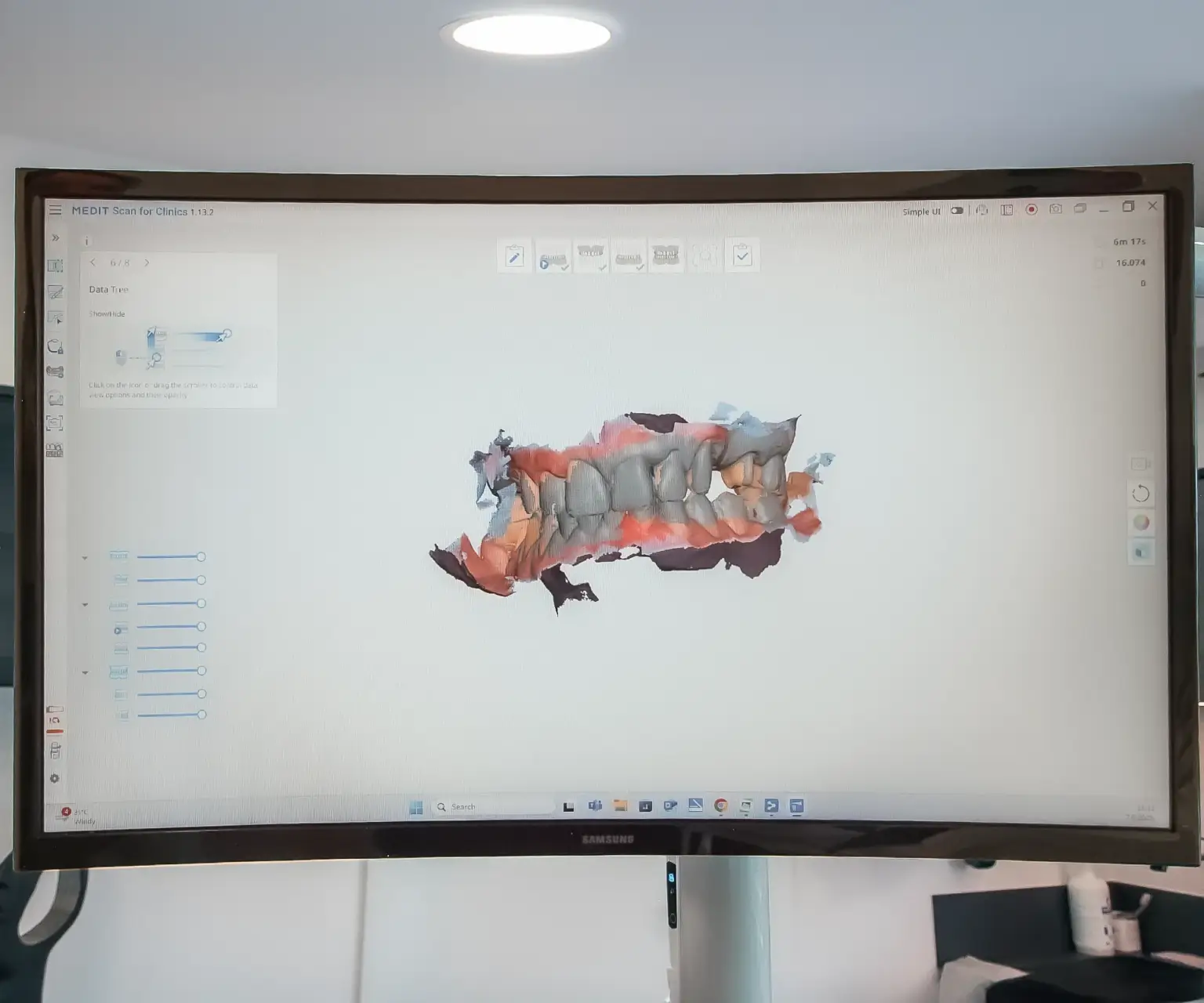 3d snimka oralnog skenera