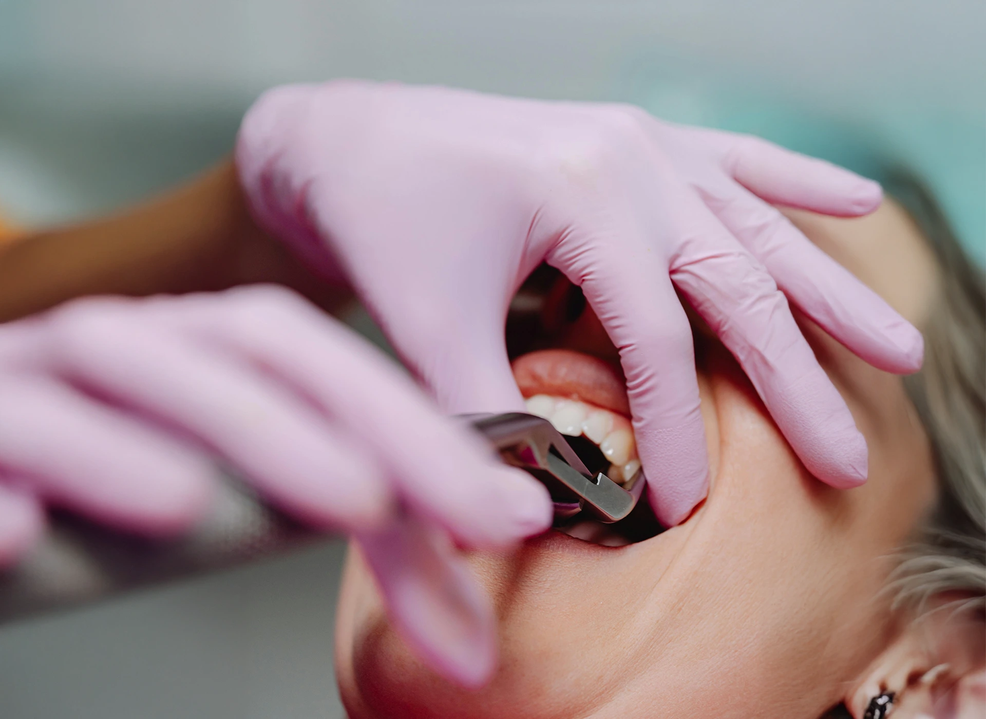 Kirurška stomatologija